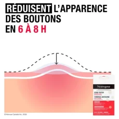 Neutrogena Anti-boutons+ Patchs imperfections ultra fins