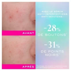 Nuxe Zinc Power Sérum Anti imperfections Anti boutons