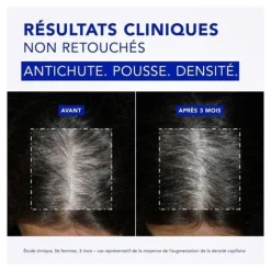 Phytocyane Intensive+ traitement antichute progressive Femme