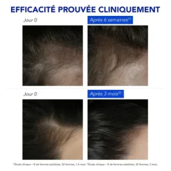 Phytophanère Antichute réactionnelle ampoule