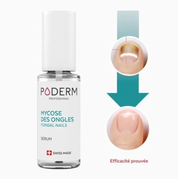 Poderm Huile Sérum Mycose des ongles