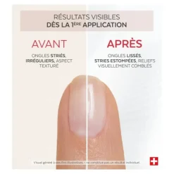 Poderm Nail corrector Comblant