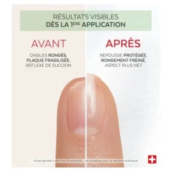 Poderm Nail corrector vernis amer