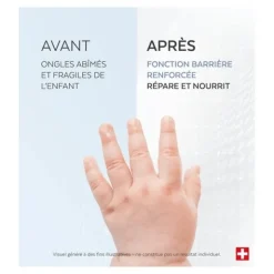 Poderm Ongles abîmés sérum kids