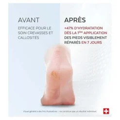 Poderm soin intensif nuit Crevasses et callosités