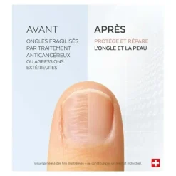 Poderm Sérum silicium Ongles fragilisés