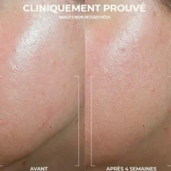 Roc Derm Correxion Crème contour Rétinol Avancé
