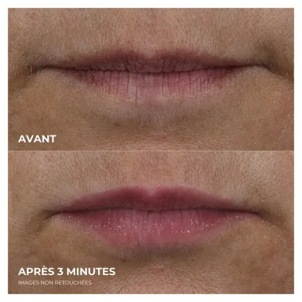 RoC Derm correxion lip volumizer soin volumateur lèvres