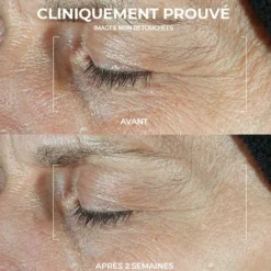 Roc Derm Correxion Soin Duo Contour des yeux