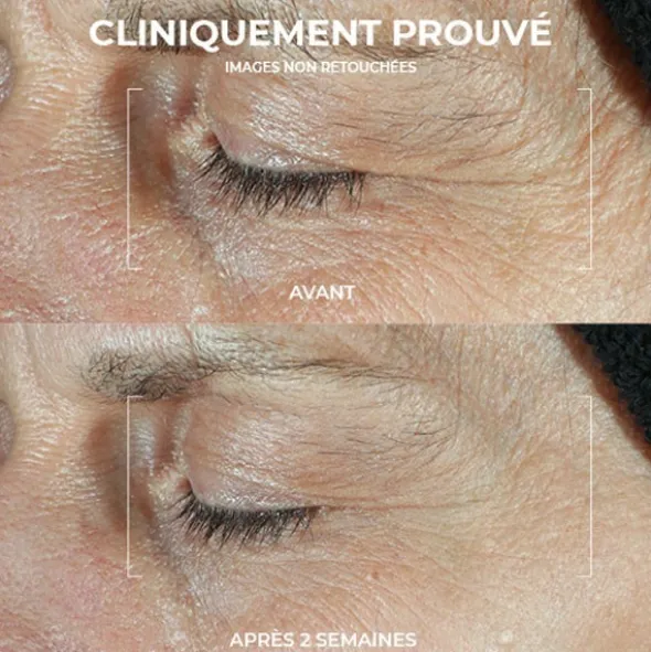 Roc Derm Correxion Soin Duo Contour des yeux