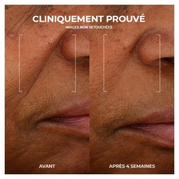 Roc Multi Correxion Crème gel Renouveau Eclat