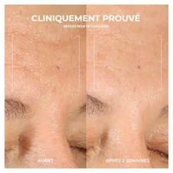 Roc Multi Correxion Renouveau + Eclat gel nettoyant
