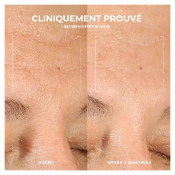 Roc Multi Correxion Renouveau + Eclat gel nettoyant