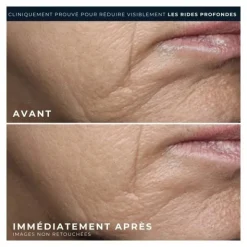 RoC Retinol Correxion correction rides crème riche