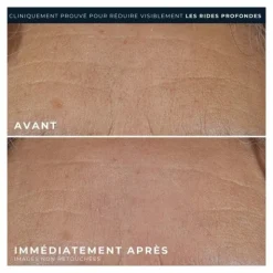 RoC Retinol Correxion correction rides crème riche