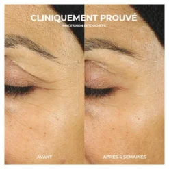 Roc Retinol Correxion Crème contour des yeux