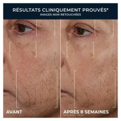 Roc Retinol Correxion Lissant rides Triple sérum