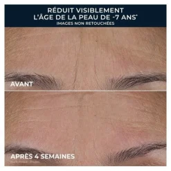 Roc Retinol Correxion Lissant rides Triple sérum