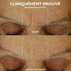 Roc Retinol Correxion soin lissant crème hydratation maximale
