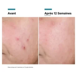 SkinCeuticals Advanced RGN-6 crème réparatrice