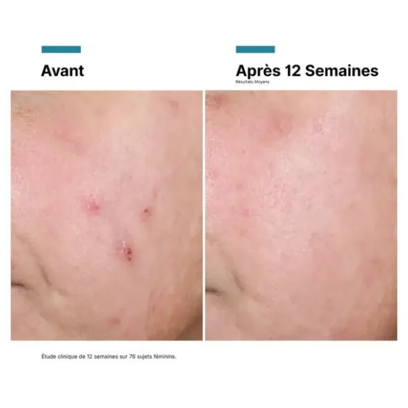 SkinCeuticals Advanced RGN-6 crème réparatrice