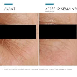 SkinCeuticals A.G.E. Advanced Eye