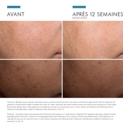 SkinCeuticals Discoloration Defense Serum