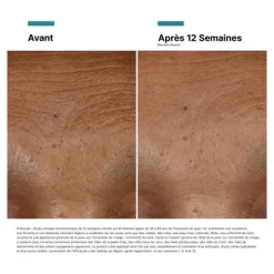 Skinceuticals HA Intensifier Multi-Glycan Sérum