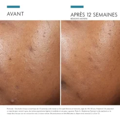 Skinceuticals Phyto A+ Brightening Treatment