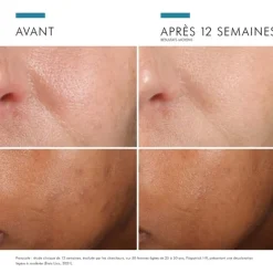 SkinCeuticals Prevent Phloretin CF sérum antioxydant
