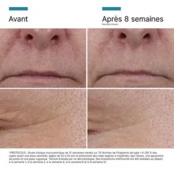 SkinCeuticals P Tiox Sérum