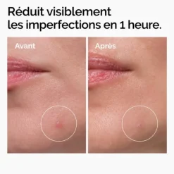 The Ordinary Concentré Crème en poudre de soufre 10%
