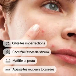 The Ordinary Concentré Crème en poudre de soufre 10%