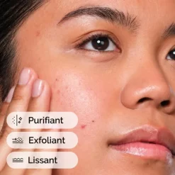 The Ordinary Solution à l'acide salicylique 2%