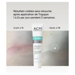 Trigopax crème