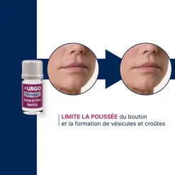 Urgo Filmogel bouton de fièvre pansement gel