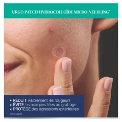 Urgo Patch hydrocolloïde micro needling boutons d'acné