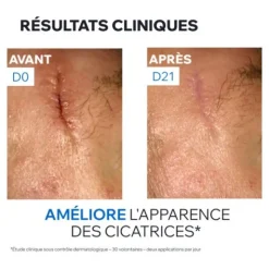 Uriage Bariéderm Cica+ Crème réparatrice