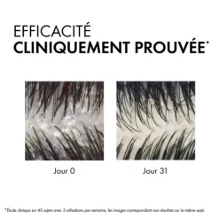 Vichy Dercos Anti-Pelliculaire DS shampooing cheveux secs