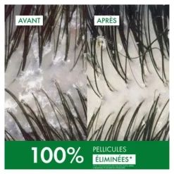 Vichy Dercos Shampooing Anti pelliculaire DS cheveux normaux à gras