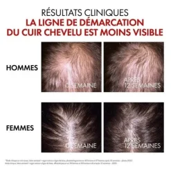 Vichy Dercos Sérum anti chute cheveux REGEN Booster