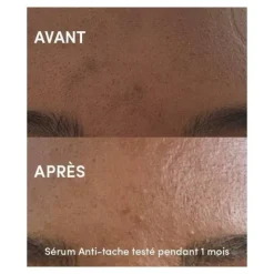 Waam sérum anti tache unifiant